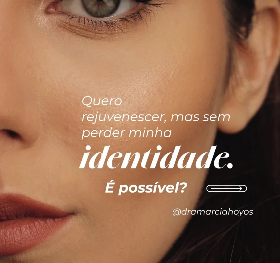 Publicação sobre rejuvenescimento facial sem perder a própria identidade